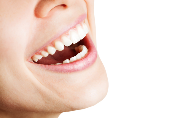 Reasons To Consider All On  ® Teeth Replacement